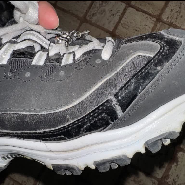 Skechers Ayakkabıda Kısa Sürede Ciddi Deformasyon Ve Mağduriyet