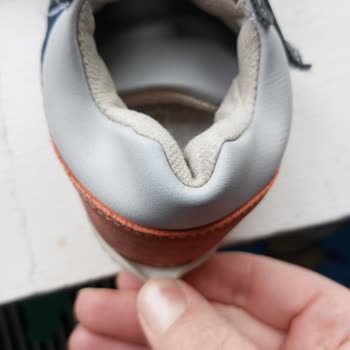 Kısa Sürede Deforme Olan Ortopedik Bebek Ayakkabısı Ve Mağaza İlgisizliği