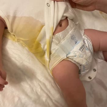 Molfix Bezlerde Sızdırma Ve Eksik Bant Sorunu Mağduriyet Yaşattı