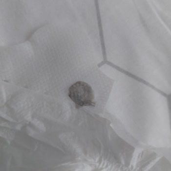 Bebek Bezinde Hijyen Skandalı: Güvenim Kırıldı