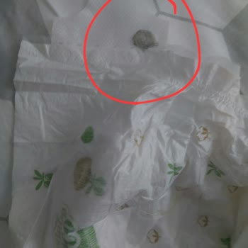 Bebek Bezinde Hijyen Skandalı: Güvenim Kırıldı