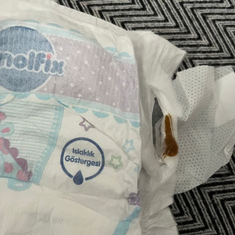 Molfix Bebek Bezlerinde Güven Sarsan Yapışkan Parçalar!