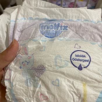 Bebek Bezinden Çıkan Demir Tel Güvenlik Endişesi Yarattı