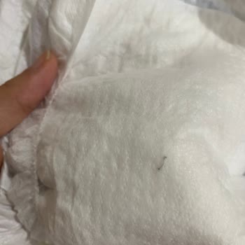 Bebek Bezinden Çıkan Demir Tel Güvenlik Endişesi Yarattı