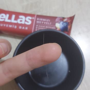 A101 Mağazasında Kedi Kılı Bulunan Ürün Ve Hijyen Sorunu!