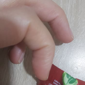 A101 Mağazasında Kedi Kılı Bulunan Ürün Ve Hijyen Sorunu!