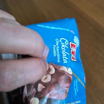 Çikolatadan Çıkan Metal Parçası Dişimi Kırdı Firma İlgisiz Kaldı