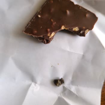 Çikolatadan Çıkan Metal Parçası Dişimi Kırdı Firma İlgisiz Kaldı