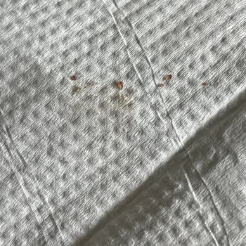 Eti Browni Intense Kekte Plastik Benzeri Yabancı Cisim Ve Sağlık Riski