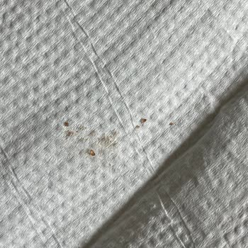 Eti Browni Intense Kekte Plastik Benzeri Yabancı Cisim Ve Sağlık Riski