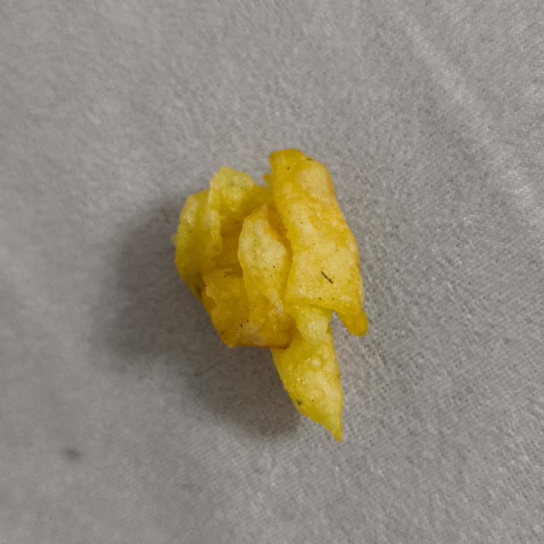 Cips Paketinden Çıkan Sert Parça Sağlığımı Tehdit Etti