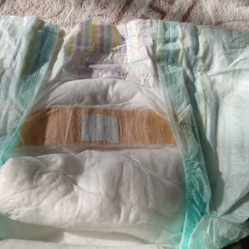 Bebek Bezinde Yabancı Cisim Ve Defolu Ürün Sorunu