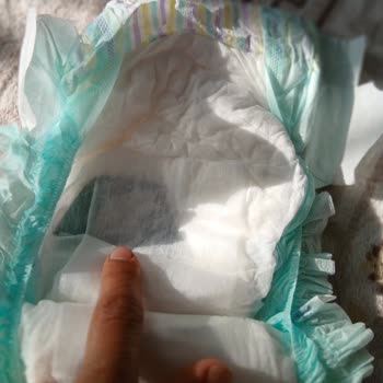 Bebek Bezinde Yabancı Cisim Ve Defolu Ürün Sorunu