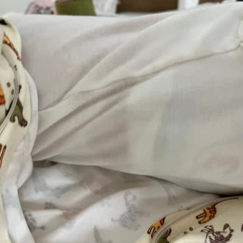 Molfix 3 Numara Bebek Bezinde Sızdırma Ve Sıvı Dağılımı Sorunu