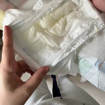 Molfix 3 Numara Bebek Bezinde Sızdırma Ve Sıvı Dağılımı Sorunu