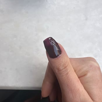 Merve Kutlu Güzellik Merkezi Hijyen Eksikliği Ve İlgisizlik Yüzünden Enfeksiyon Kaptım
