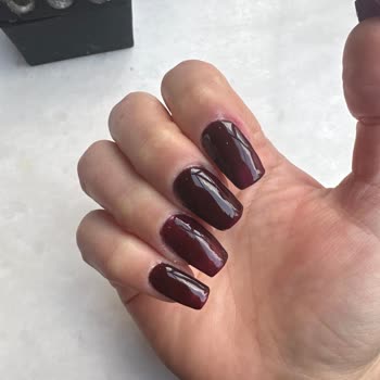 Merve Kutlu Güzellik Merkezi Hijyen Eksikliği Ve İlgisizlik Yüzünden Enfeksiyon Kaptım