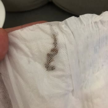 Molfix Bebek Bezinde Yabancı Madde Ve Güven Sorunu