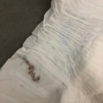 Molfix Bebek Bezinde Yabancı Madde Ve Güven Sorunu