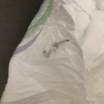 Molfix Bebek Bezinde Yabancı Madde Ve Güven Sorunu