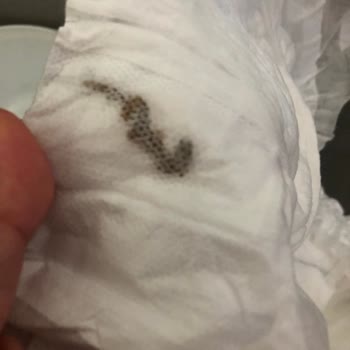 Molfix Bebek Bezinde Yabancı Madde Ve Güven Sorunu