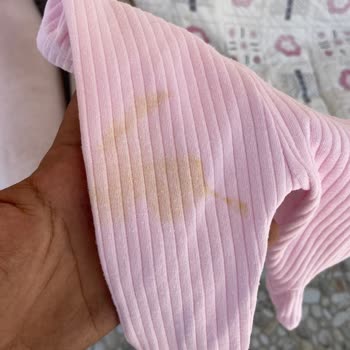 Servis Sorunu Ve Tekrarlayan Arıza Nedeniyle Kıyafetler Lekeli Çıkıyor