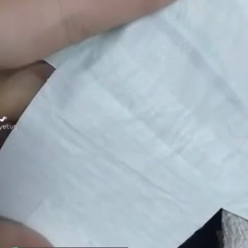 Jenny & Willy 5 Numara Bebek Bezi Kalitesizliği