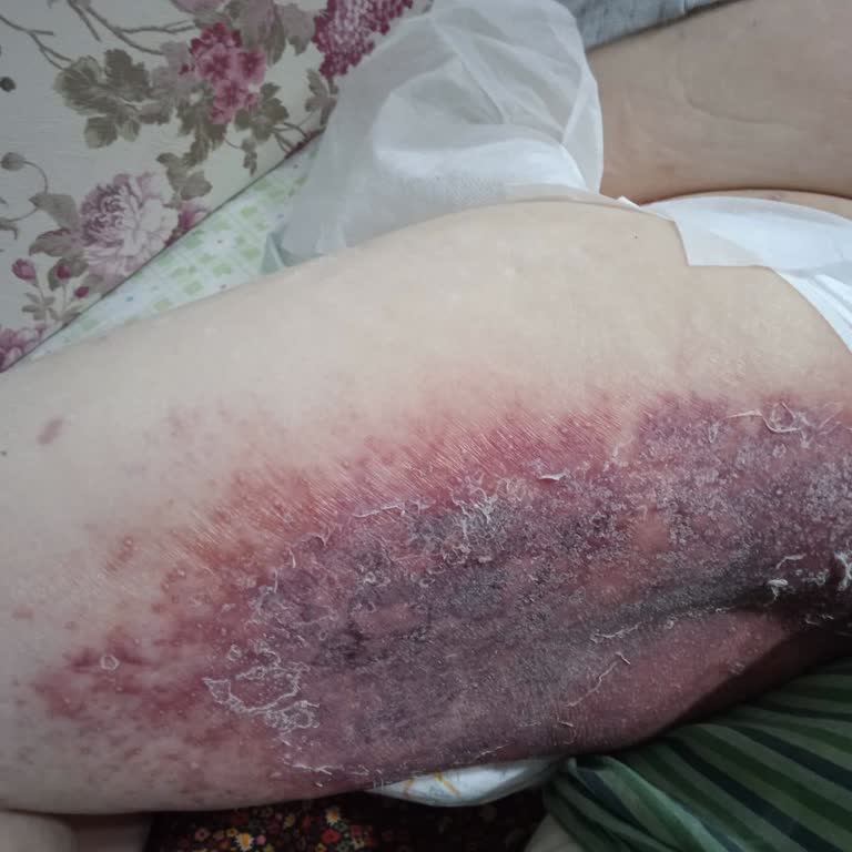 Yoğun Bakımdan Bilgisiz Sevk Ve Sonrası Vefat: Hastane Sürecindeki İhmaller