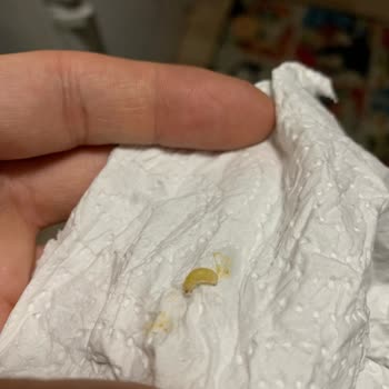 Beypazarı Soda Şişesinde Kurt Çıkması Ve Hijyen Sorunu