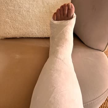 Kaygan Zemin Nedeniyle Parkta Ciddi Kaza Ve Güvenlik Riski