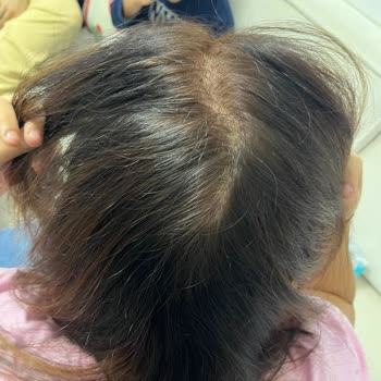 Görkem Akademi | Şirinevler Ortaya Çok Kötü, Düzensiz Bir Görüntü Çıktı