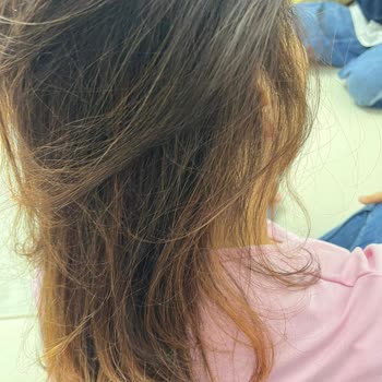 Görkem Akademi | Şirinevler Ortaya Çok Kötü, Düzensiz Bir Görüntü Çıktı