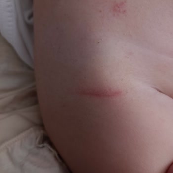 Prima Premium Care Bezlerinde Kalite Düşüşü Ve Cilt Tahrişi Sorunu