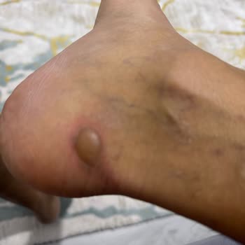 Tamirden Sonra Tekrarlayan Arıza Ve Ciddi Yanık Mağduriyeti