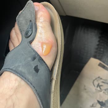 Tamirden Sonra Tekrarlayan Arıza Ve Ciddi Yanık Mağduriyeti