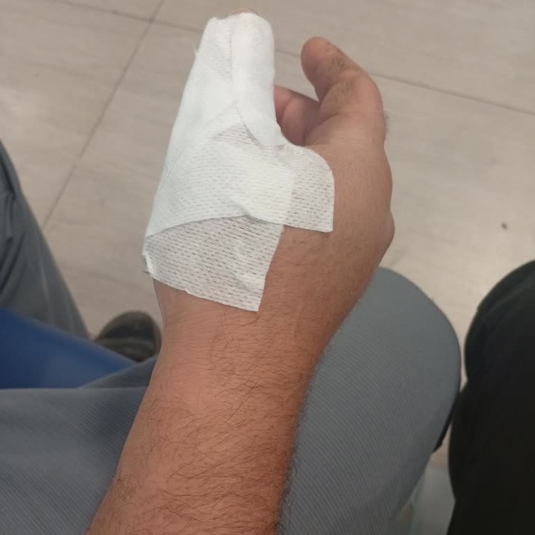 Kırık Parmakla Saatlerce Bekletildik, Bilgilendirme Yapılmadı