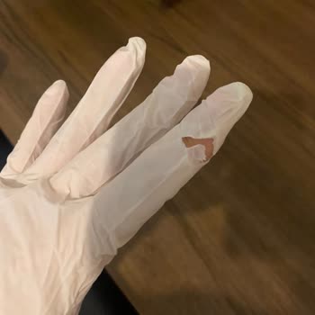 Aldığım Eldiven Paketi Yırtık Çıktı, Güvenim Sarsıldı