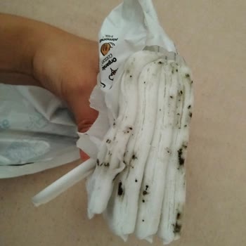 Yenidoğan Bebekler İçin Alınan Islak Mendillerde Küf Sorunu Ve Sağlık Endişesi