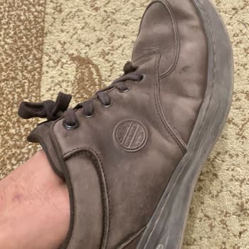 Kısa Sürede Renk Atan Ayakkabı İçin Değişim Talebim Reddedildi