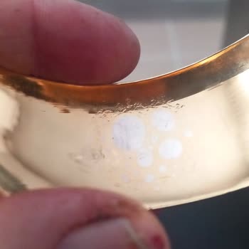 Kusurlu Bilezik Ve Satıcıya Ulaşamama Mağduriyeti