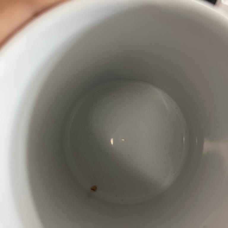 Aldığım Atıştırmalıktan Çıkan Sert Cisim Dişimi Kırdı: Sağlığım Ve Güvenim Tehlikede