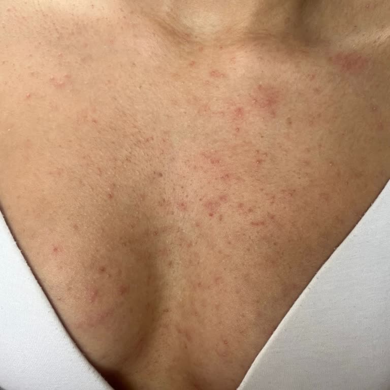 Cildiye Muayenesinde Yetersiz İlgi Ve Teşhis