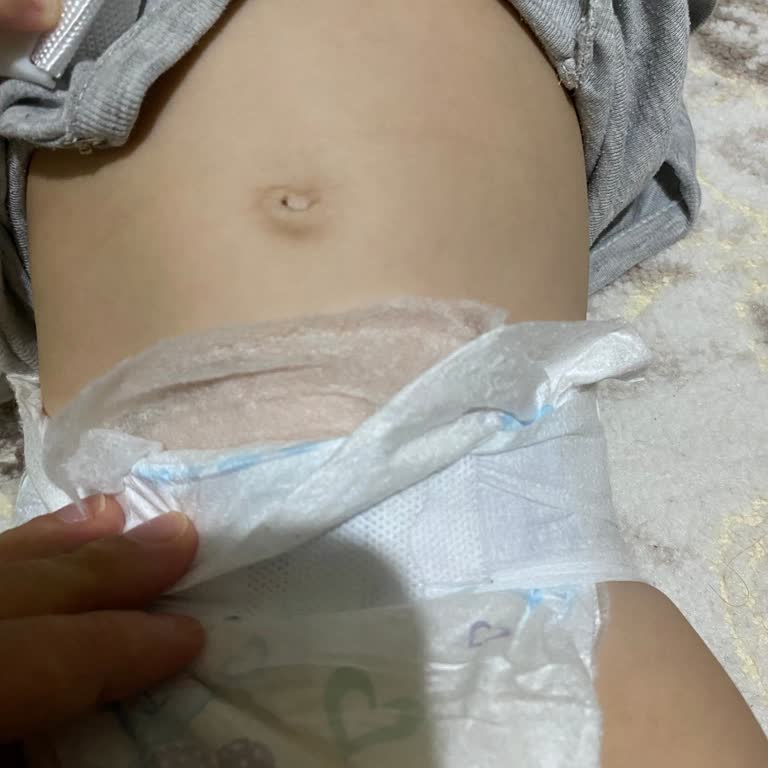Molfix 5 Numara Bezde Üretim Kaynaklı Sızdırma Ve İç Kısım Sorunu