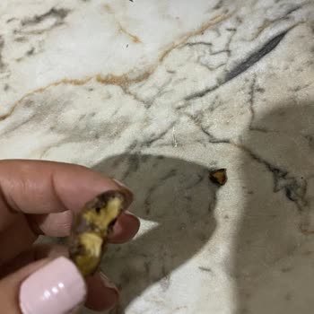 Hazır Çikolatadan Çıkan Ceviz Kabuğu Dişimi Kırdı, Sağlık Masraflarım Karşılanmalı