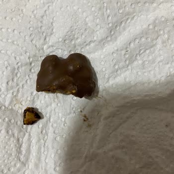 Hazır Çikolatadan Çıkan Ceviz Kabuğu Dişimi Kırdı, Sağlık Masraflarım Karşılanmalı