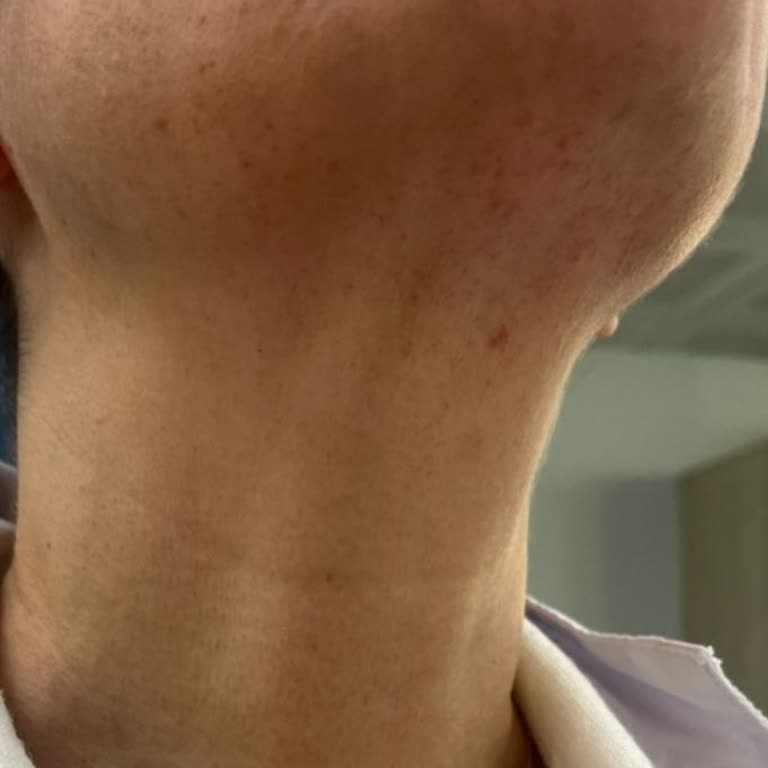 Komagene'den Aldığım Dürüm Sağlığımı Ciddi Şekilde Tehdit Etti