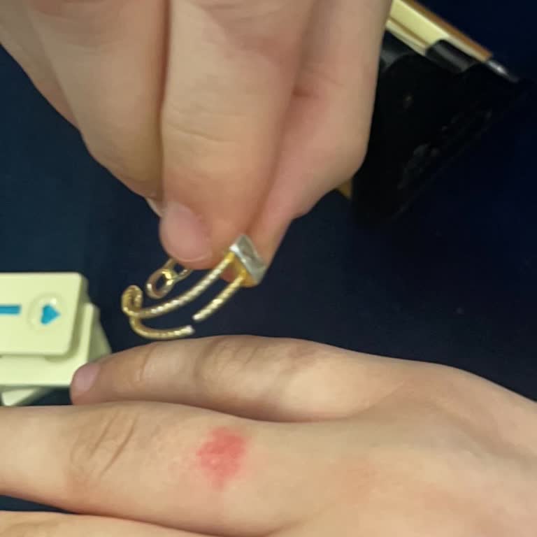 Alerji Ve Kalite Sorunlu Yüzük İçin Kalıcı Çözüm Bekliyorum