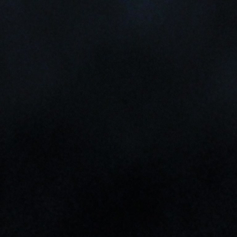 Garantisi Devam Eden Araçta Fren Sorunu Ve Güvenlik Endişesi