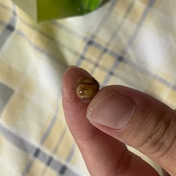 Aldığım Çikolatadan Yabancı Madde Çıkması Nedeniyle Güven Kaybı Ve Mağduriyet