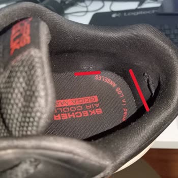 Kısa Sürede Deforme Olan Skechers Ayakkabı Ve İade Sorunu